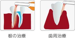 光殺菌