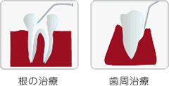 洗浄