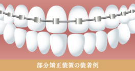ha11